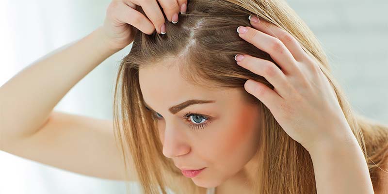 único dominio bicapa Alopecia femenina: solución y tratamiento (caída del cabello en mujeres)