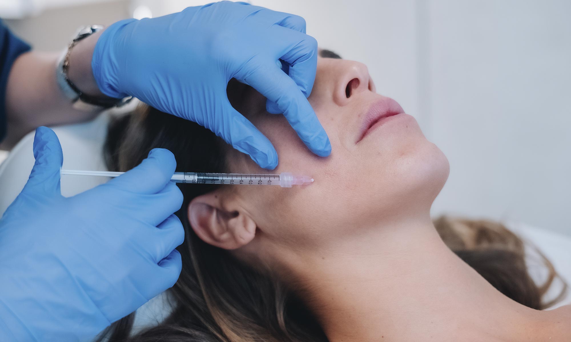 tratamiento mesoterapia facial en malaga